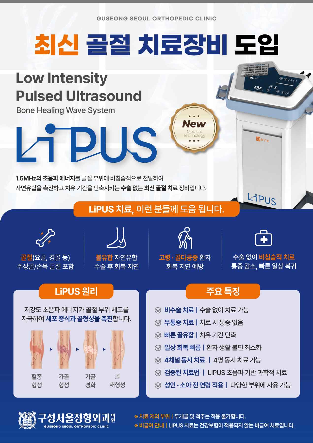 �ֽ� ���� ġ�� ��� 'LIPUS' ���� �ȳ�